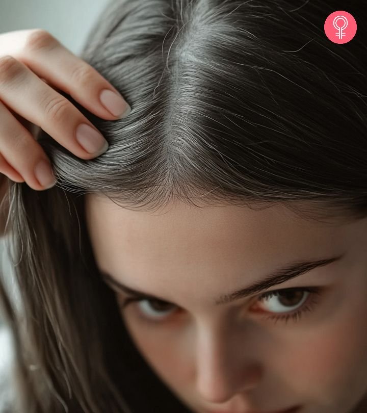 بالوں میں سفیدی
